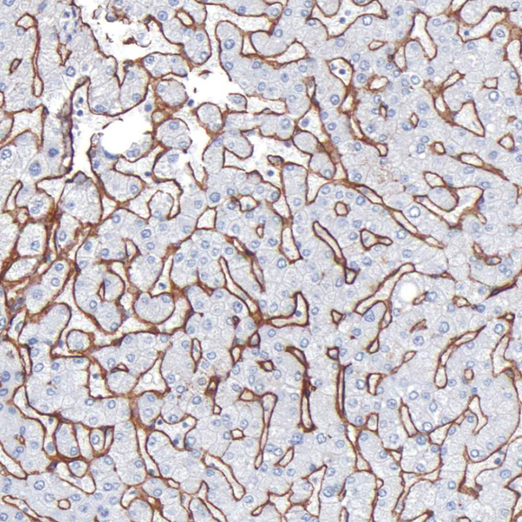 Collagen Type IV Antibody - Clover Biosciences, LLC