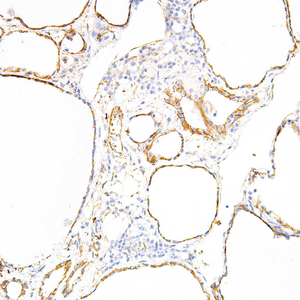 Tau Antibody - Clover Biosciences, LLC